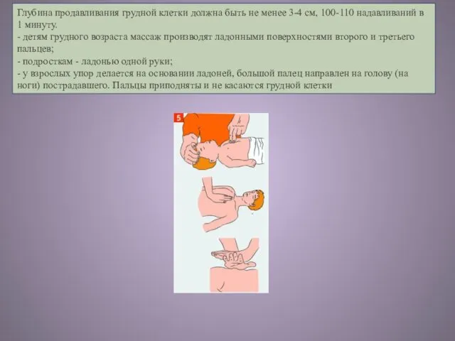 Глубина продавливания грудной клетки должна быть не менее 3-4 см, 100-110 надавливаний в