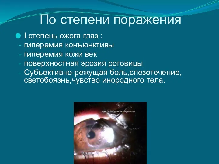 По степени поражения I степень ожога глаз : гиперемия конъюнктивы