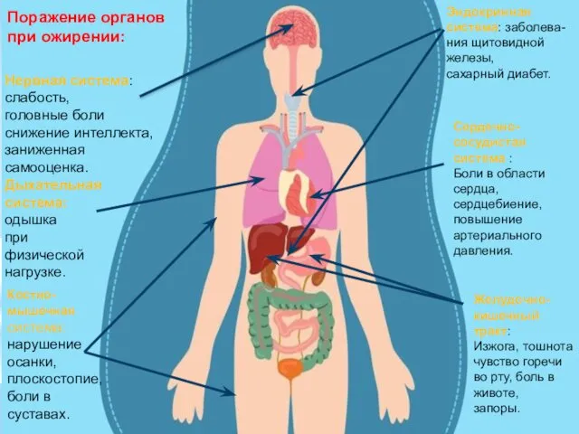 Поражение органов при ожирении: Нервная система: слабость, головные боли снижение