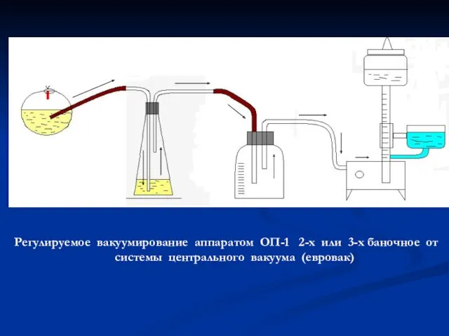 Регулируемое вакуумирование аппаратом ОП-1 2-х или 3-х баночное от системы центрального вакуума (евровак)
