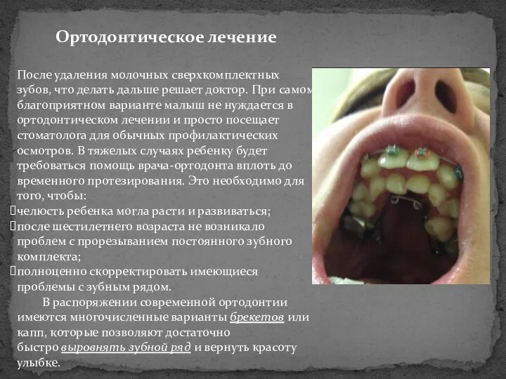 Ортодонтическое лечение После удаления молочных сверхкомплектных зубов, что делать дальше