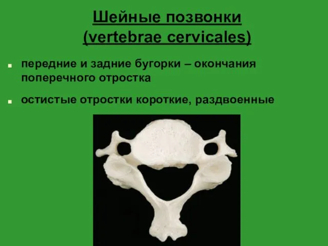 Шейные позвонки (vertebrae cervicales) передние и задние бугорки – окончания поперечного отростка остистые отростки короткие, раздвоенные