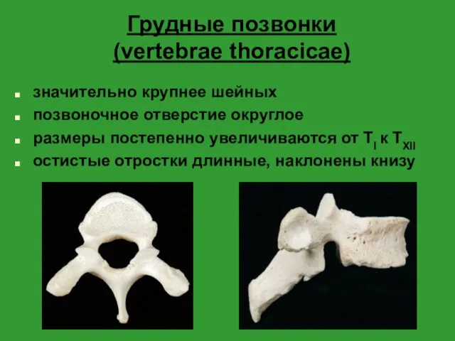 Грудные позвонки (vertebrae thoracicae) значительно крупнее шейных позвоночное отверстие округлое