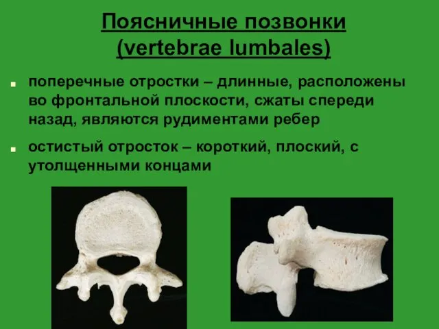 Поясничные позвонки (vertebrae lumbales) поперечные отростки – длинные, расположены во