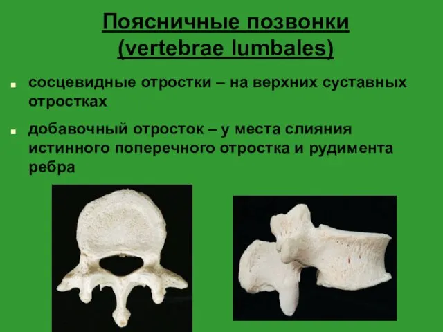 Поясничные позвонки (vertebrae lumbales) сосцевидные отростки – на верхних суставных