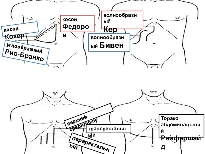 параректальный углообразный Рио-Бранко косой Кохер косой Федоров волнообразный Кер волнообразный