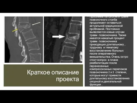 Краткое описание проекта Проблемы патологий и травм позвоночного столба продолжают