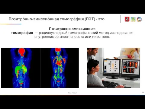 tele-med.ai Позитро́нно-эмиссио́нная томогра́фия (ПЭТ) - это Позитро́нно-эмиссио́нная томогра́фия — радионуклидный томографический метод исследования