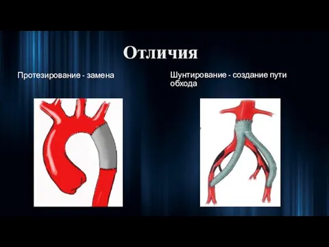 Отличия Шунтирование - создание пути обхода Протезирование - замена