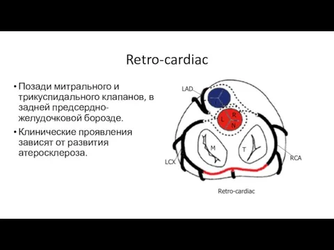 Retro-cardiac Позади митрального и трикуспидального клапанов, в задней предсердно-желудочковой борозде. Клинические проявления зависят от развития атеросклероза.