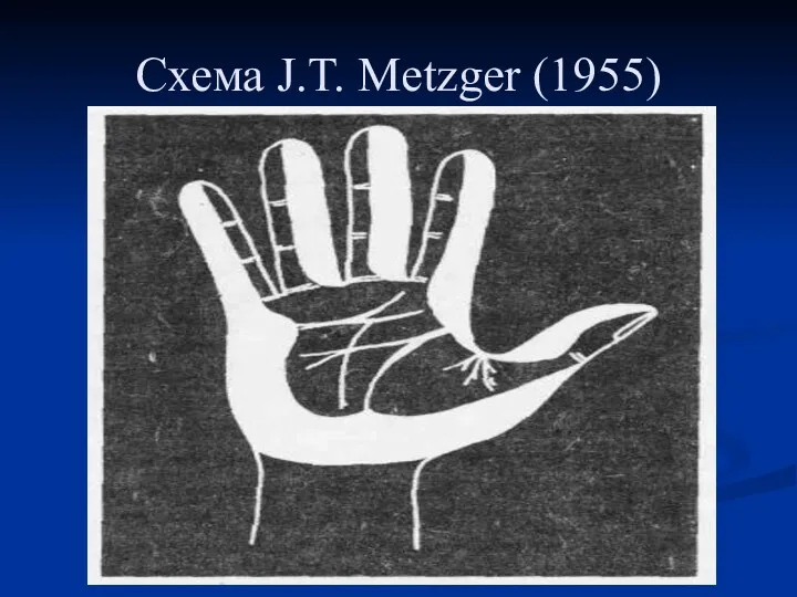 Схема J.T. Metzger (1955)