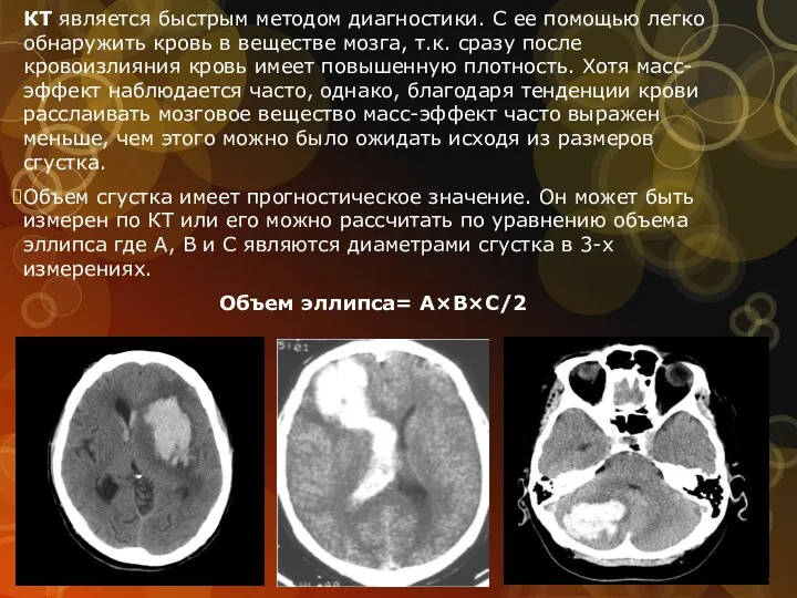 КТ является быстрым методом диагностики. С ее помощью легко обнаружить