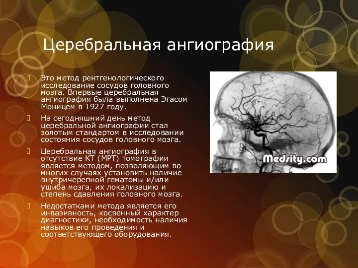 Церебральная ангиография Это метод рентгенологического исследование сосудов головного мозга. Впервые