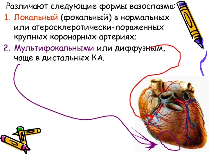 Различают следующие формы вазоспазма: Локальный (фокальный) в нормальных или атеросклеротически-пораженных