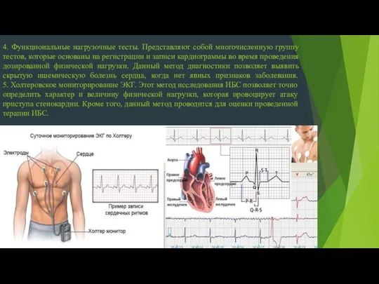 4. Функциональные нагрузочные тесты. Представляют собой многочисленную группу тестов, которые