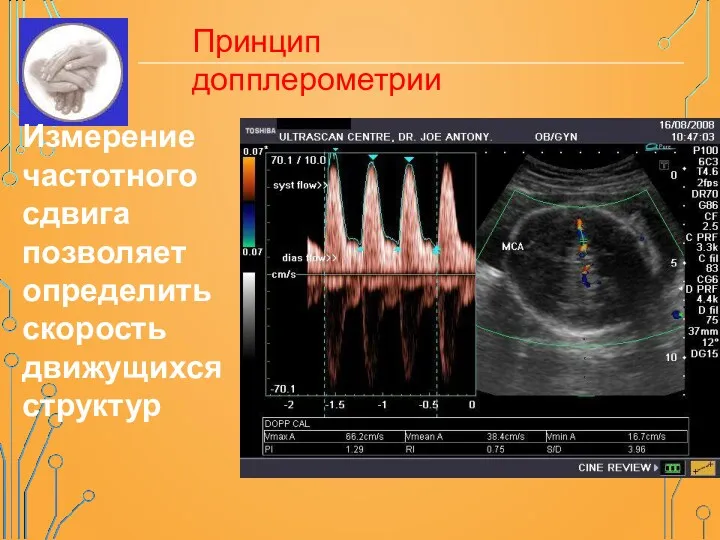 Измерение частотного сдвига позволяет определить скорость движущихся структур Принцип допплерометрии