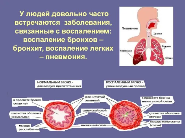 У людей довольно часто встречаются заболевания, связанные с воспалением: воспаление