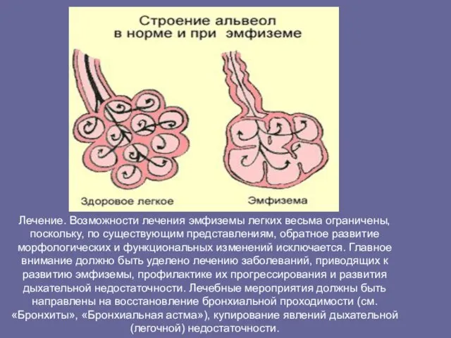 Лечение. Возможности лечения эмфиземы легких весьма ограничены, поскольку, по существующим