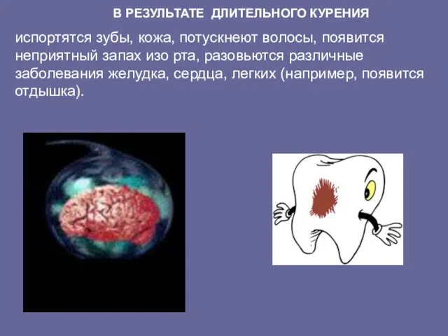 В РЕЗУЛЬТАТЕ ДЛИТЕЛЬНОГО КУРЕНИЯ испортятся зубы, кожа, потускнеют волосы, появится