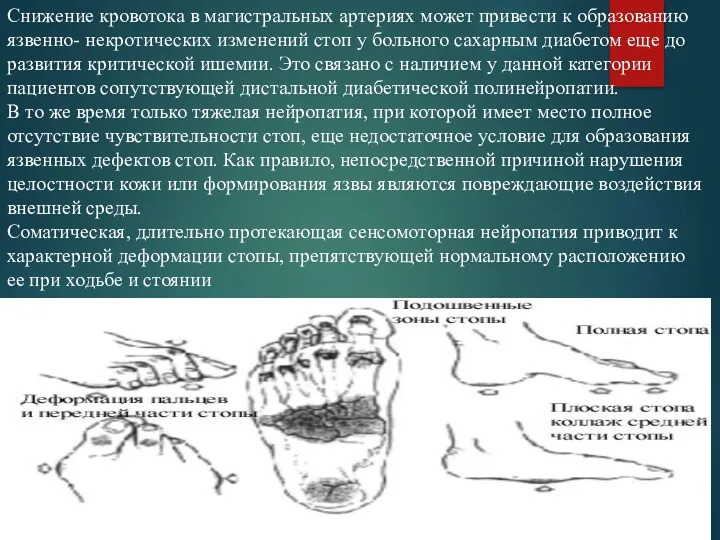 Снижение кровотока в магистральных артериях может привести к образованию язвенно-