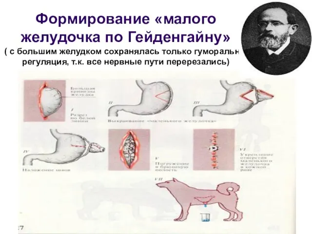 Формирование «малого желудочка по Гейденгайну» ( с большим желудком сохранялась