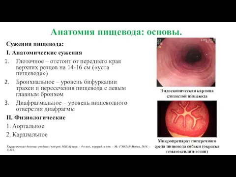 Анатомия пищевода: основы. Сужения пищевода: I. Анатомические сужения Глоточное –