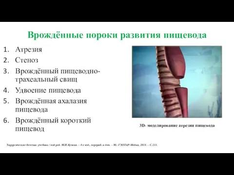 Врождённые пороки развития пищевода Атрезия Стеноз Врождённый пищеводно-трахеальный свищ Удвоение