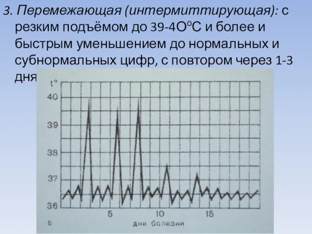 3. Перемежающая (интермиттирующая): с резким подъёмом до 39-4ОоС и более