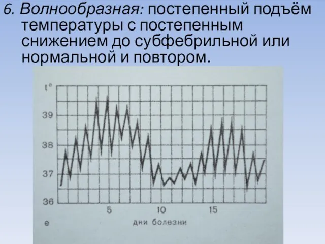 6. Волнообразная: постепенный подъём температуры с постепенным снижением до субфебрильной или нормальной и повтором.