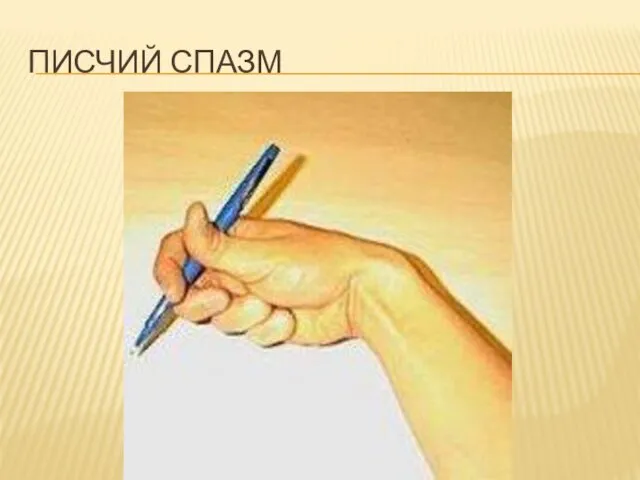 ПИСЧИЙ СПАЗМ