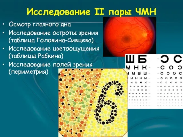 Исследование II пары ЧМН Осмотр глазного дна Исследование остроты зрения