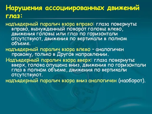 Нарушения ассоциированных движений глаз: надъядерный паралич взора вправо: глаза повернуты