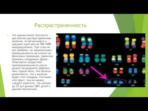 Распрастраненность Эта хромосомная патология — достаточно распространенное явление, встречающееся в