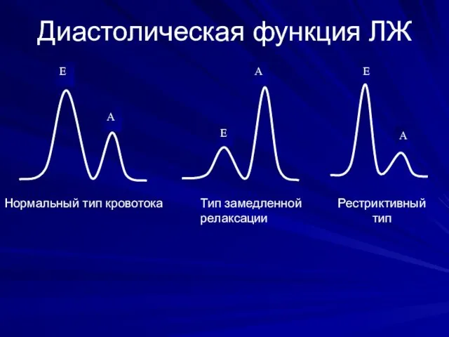 Диастолическая функция ЛЖ Нормальный тип кровотока Тип замедленной релаксации Рестриктивный тип Е