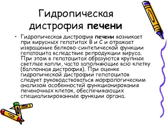 Гидропическая дистрофия печени Гидропическая дистрофия печени возникает при вирусных гепатитах