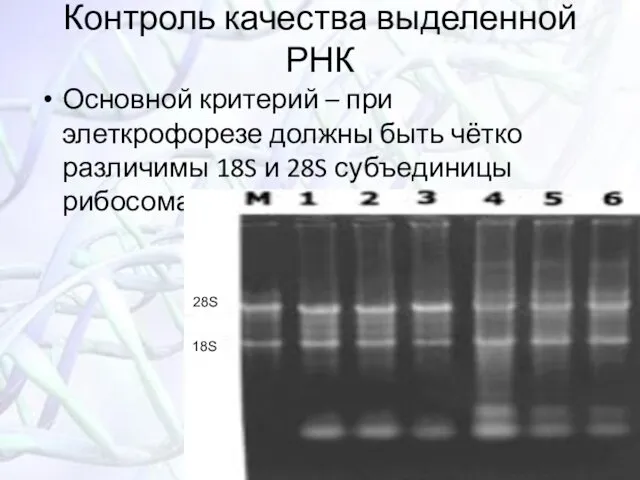 Контроль качества выделенной РНК Основной критерий – при элеткрофорезе должны