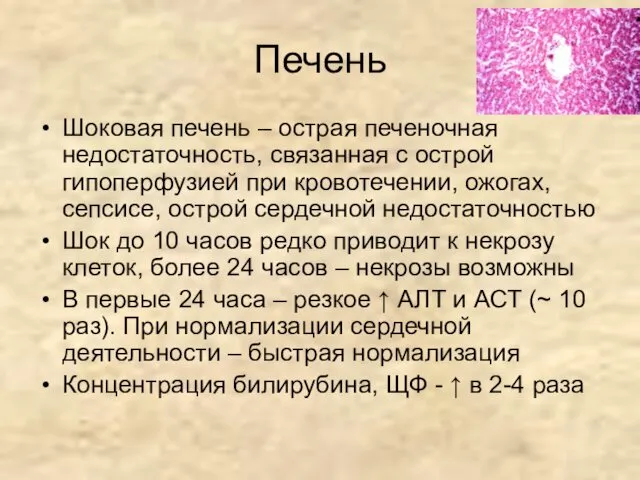 Печень Шоковая печень – острая печеночная недостаточность, связанная с острой