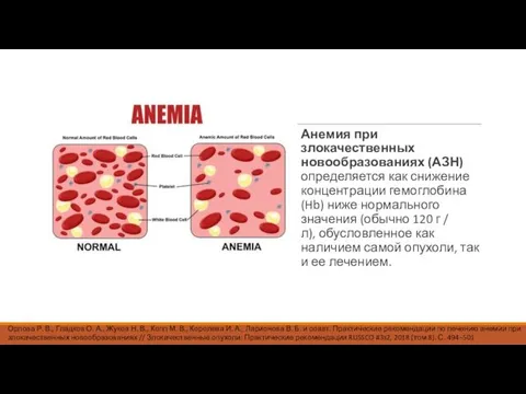 Анемия при злокачественных новообразованиях (АЗН) определяется как снижение концентрации гемоглобина