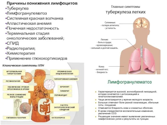 Причины понижения лимфоцитов Туберкулез Лимфогранулематоз Системная красная волчанка Апластическая анемия