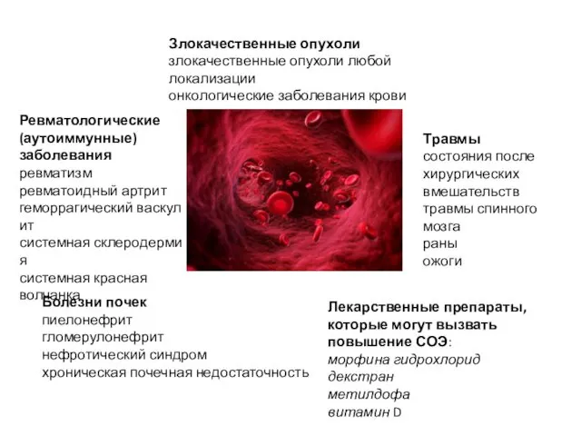 Злокачественные опухоли злокачественные опухоли любой локализации онкологические заболевания крови Ревматологические