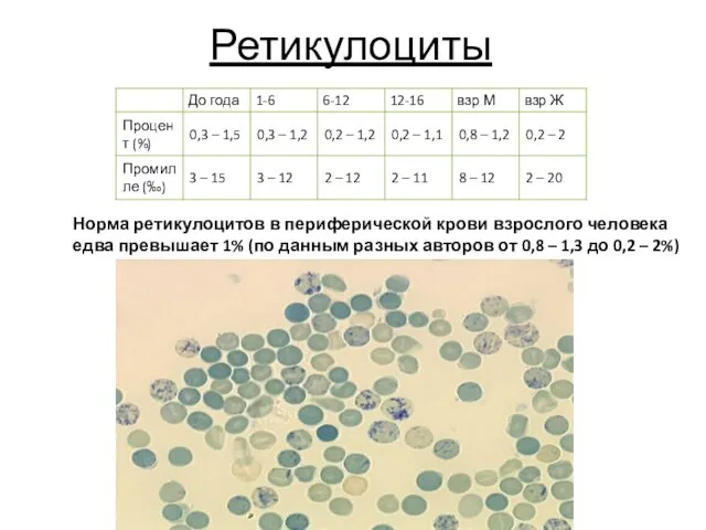 Ретикулоциты Норма ретикулоцитов в периферической крови взрослого человека едва превышает