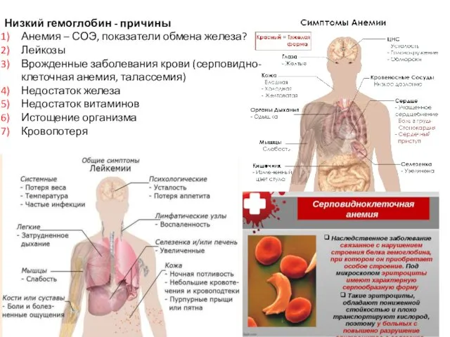 Низкий гемоглобин - причины Анемия – СОЭ, показатели обмена железа?