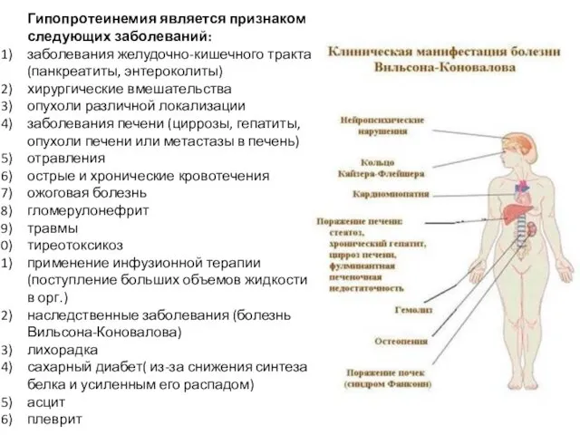 Гипопротеинемия является признаком следующих заболеваний: заболевания желудочно-кишечного тракта (панкреатиты, энтероколиты)