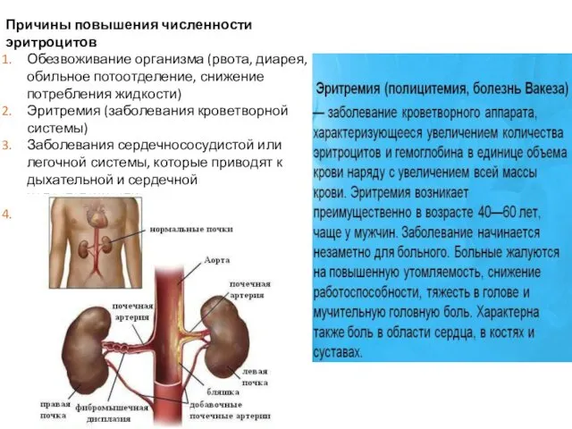 Причины повышения численности эритроцитов Обезвоживание организма (рвота, диарея, обильное потоотделение,