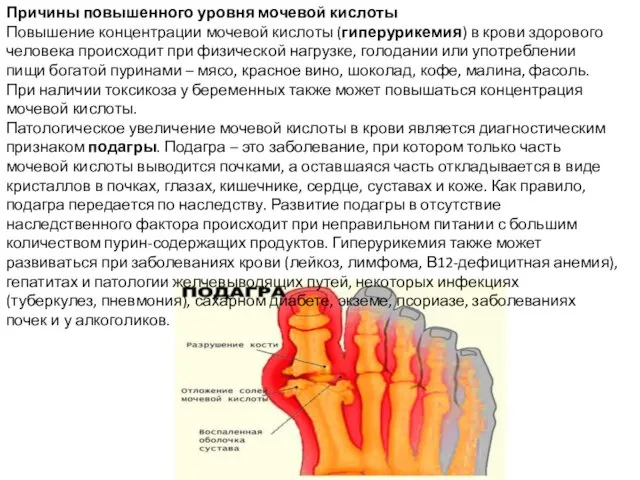 Причины повышенного уровня мочевой кислоты Повышение концентрации мочевой кислоты (гиперурикемия)