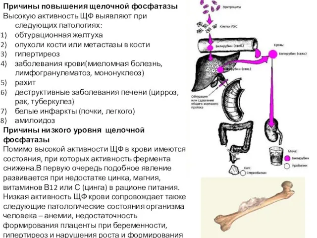 Причины повышения щелочной фосфатазы Высокую активность ЩФ выявляют при следующих