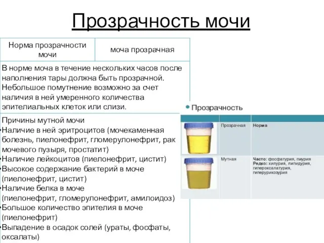 Прозрачность мочи