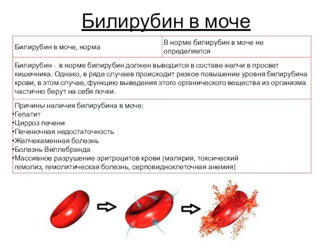 Билирубин в моче