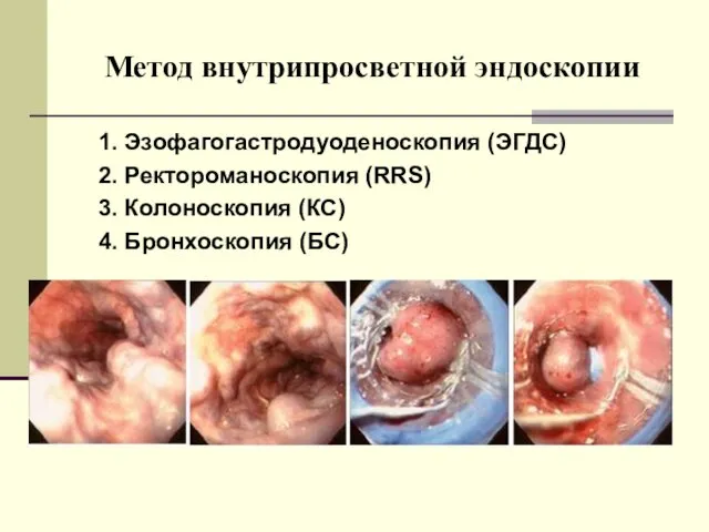 Метод внутрипросветной эндоскопии 1. Эзофагогастродуоденоскопия (ЭГДС) 2. Ректороманоскопия (RRS) 3. Колоноскопия (КС) 4. Бронхоскопия (БС)