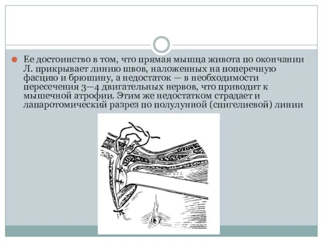 Ее достоинство в том, что прямая мышца живота по окончании